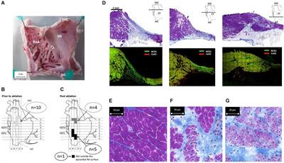 Structural and Functional Properties of Subsidiary Atrial Pacemakers in a Goat Model of Sinus Node Disease